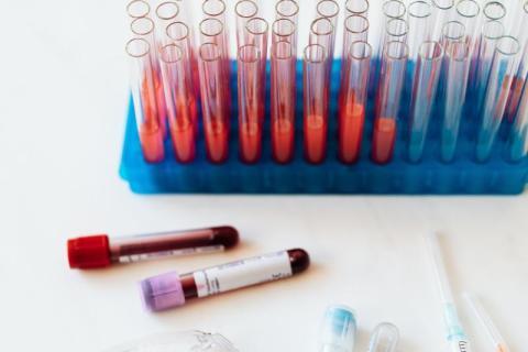 Le temps d'occlusion en remplacement du temps de saignement