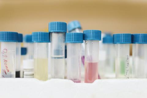 calcul du TTR et dosage des NACO