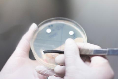 Dans un soucis constant d’amélioration, le laboratoire BIONEXT actualise les comptes-rendus d’antibiogrammes selon les dernières recommandations européennes (EUCAST)