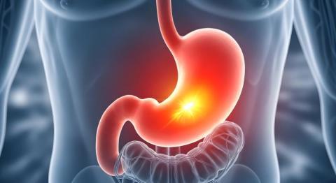 Newsletter Helicobacter Pylori