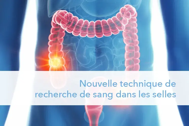 Nouvelle technique de recherche de sang dans les selles